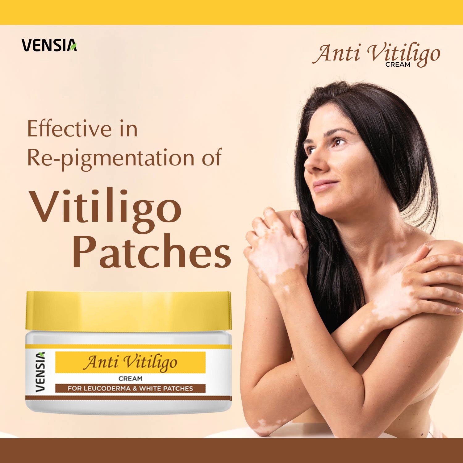 best cream for vitiligo treatment