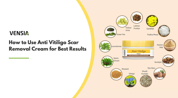 Anti Vitiligo Scar Removal Cream for Best Results
