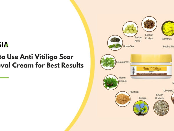 Anti Vitiligo Scar Removal Cream for Best Results