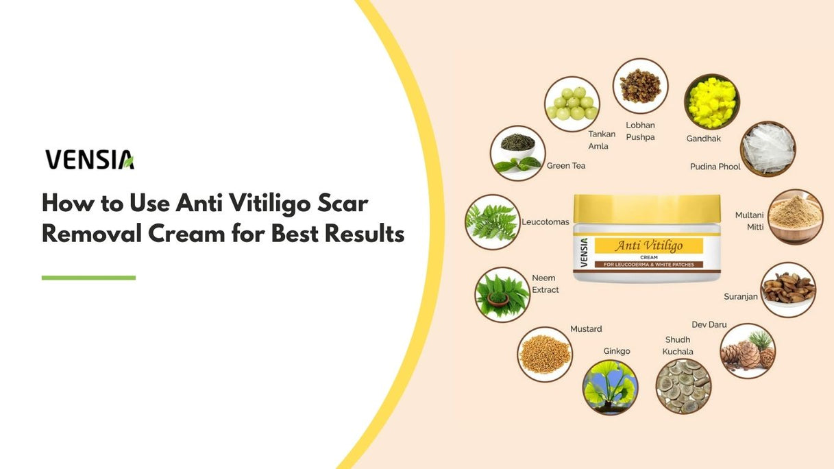 Anti Vitiligo Scar Removal Cream for Best Results