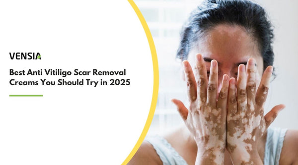 Best Anti Vitiligo Scar Removal Creams 