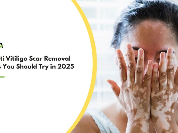 Best Anti Vitiligo Scar Removal Creams 
