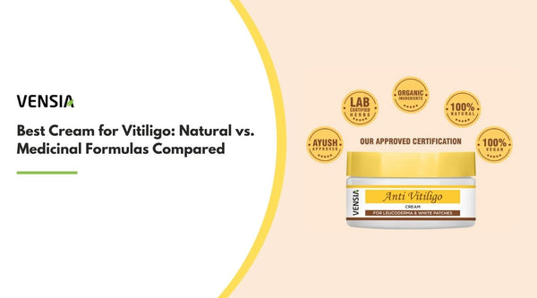 best cream for vitiligo