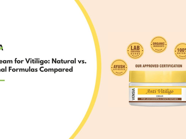 best cream for vitiligo
