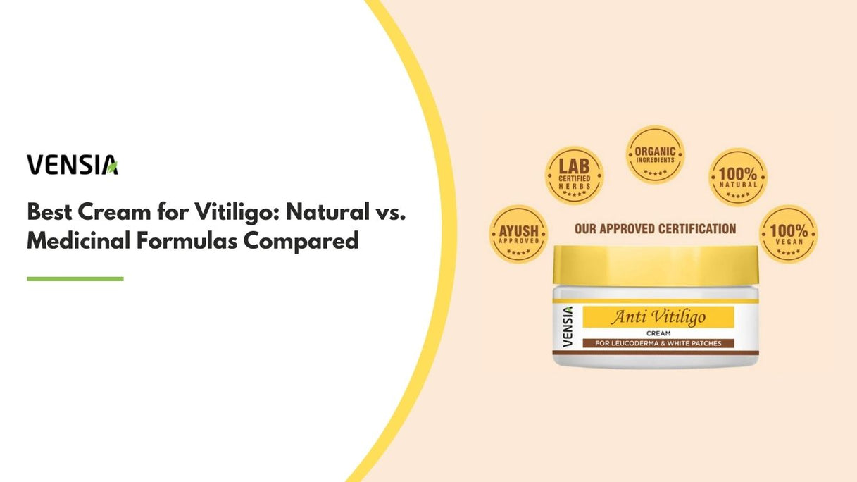 best cream for vitiligo