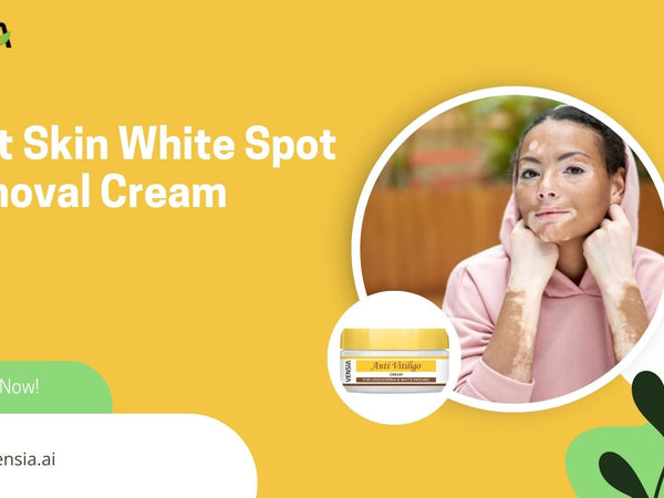 How to Choose the Best Skin White Spot Removal Cream 