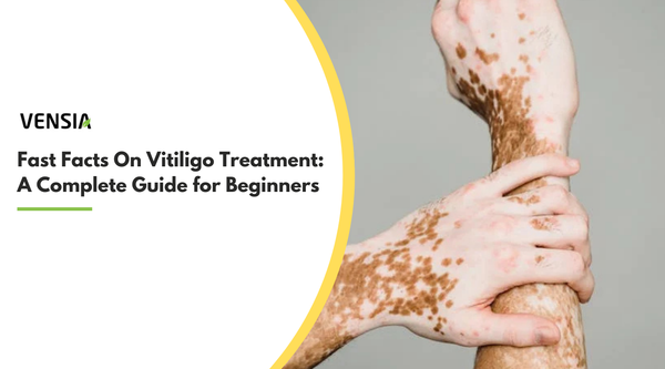 Fast Facts On Vitiligo Treatment: a Complete Guide for Beginners