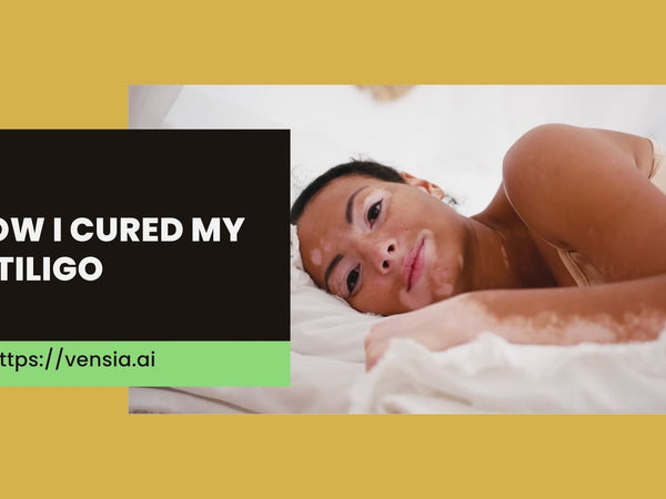 How Should I care My Vitiligo