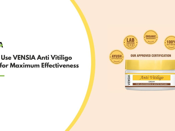 How to Use VENSIA Anti Vitiligo Cream for Maximum Effectiveness
