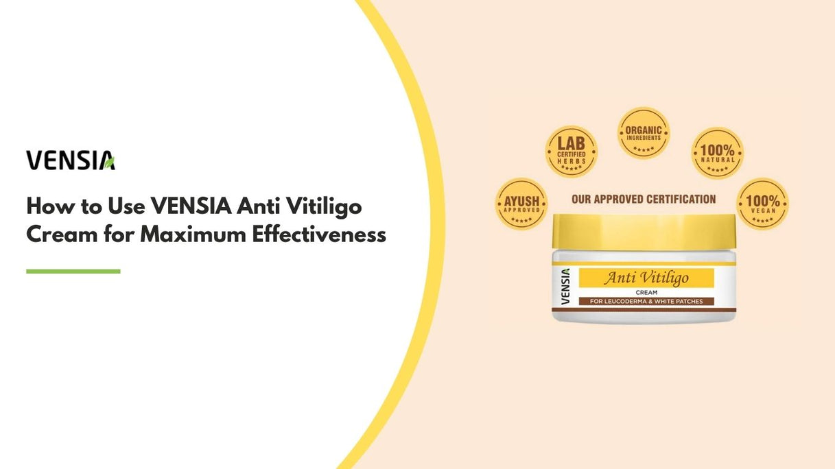 How to Use VENSIA Anti Vitiligo Cream for Maximum Effectiveness