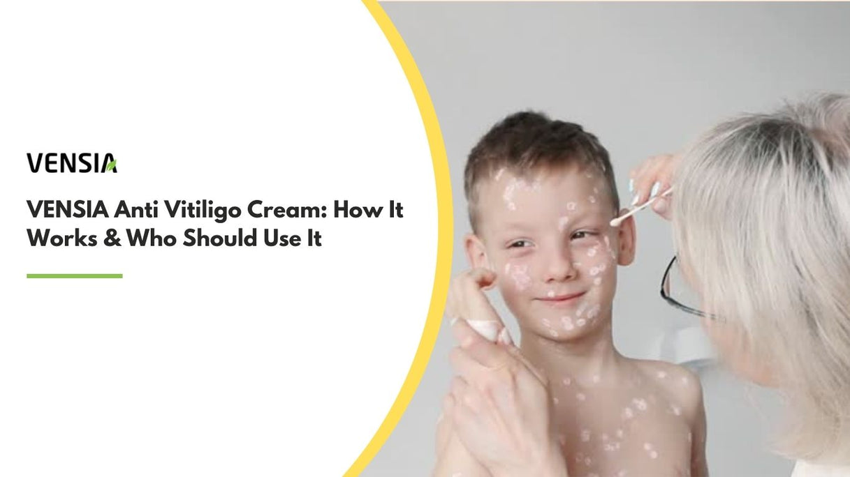 VENSIA Anti Vitiligo Cream How It Works & Who Should Use It
