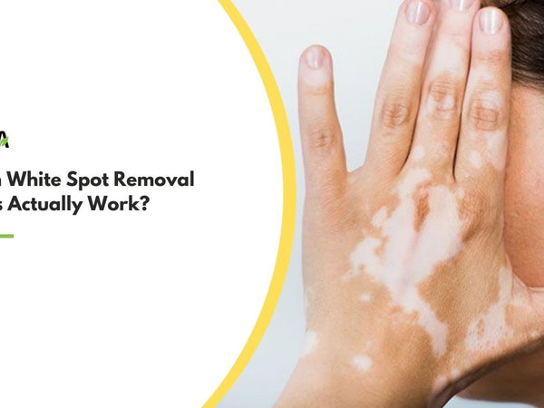 Do Skin White Spot Removal  Creams Actually Work