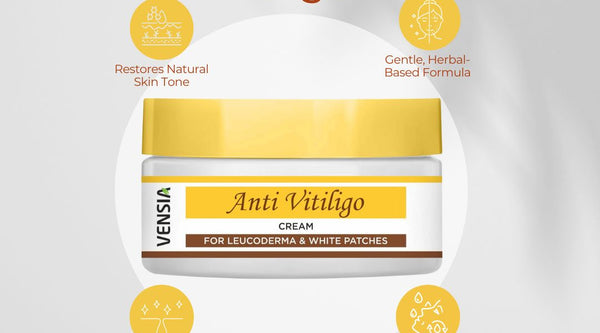 What Is the Best Treatment for Vitiligo