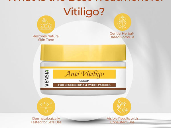What Is the Best Treatment for Vitiligo