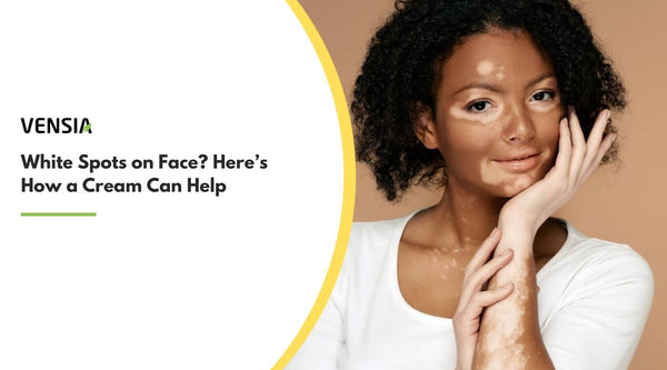 Solution of White Spots on Face