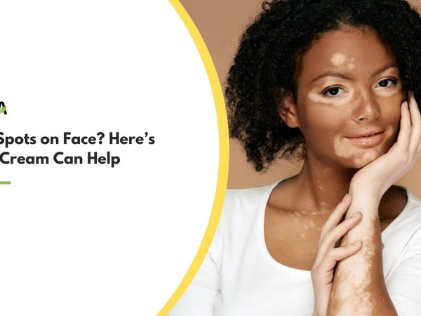 Solution of White Spots on Face