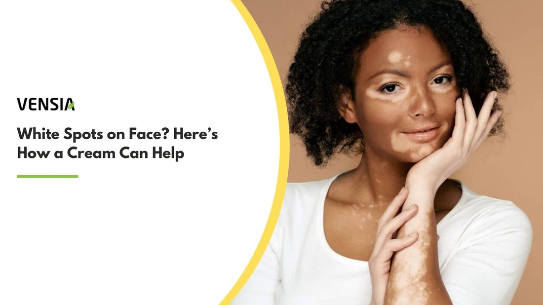 Solution of White Spots on Face