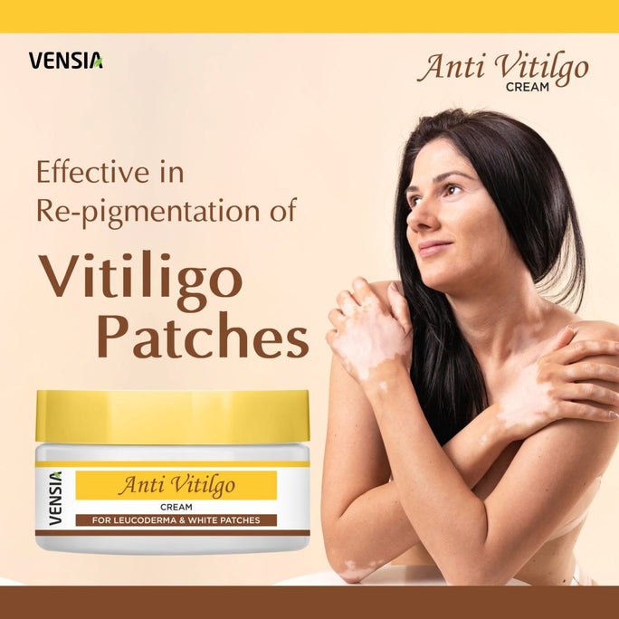VENSIA Anti Vitiligo Cream: 2026 Repigmentation Guide