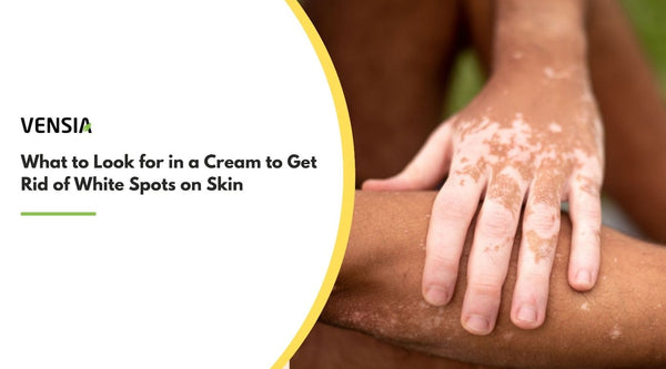 cream to get rid of white spots on skin