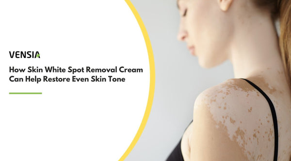 skin white spot removal cream
