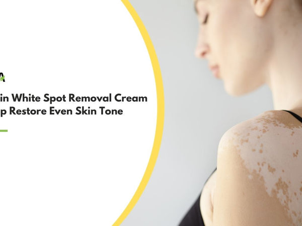 skin white spot removal cream