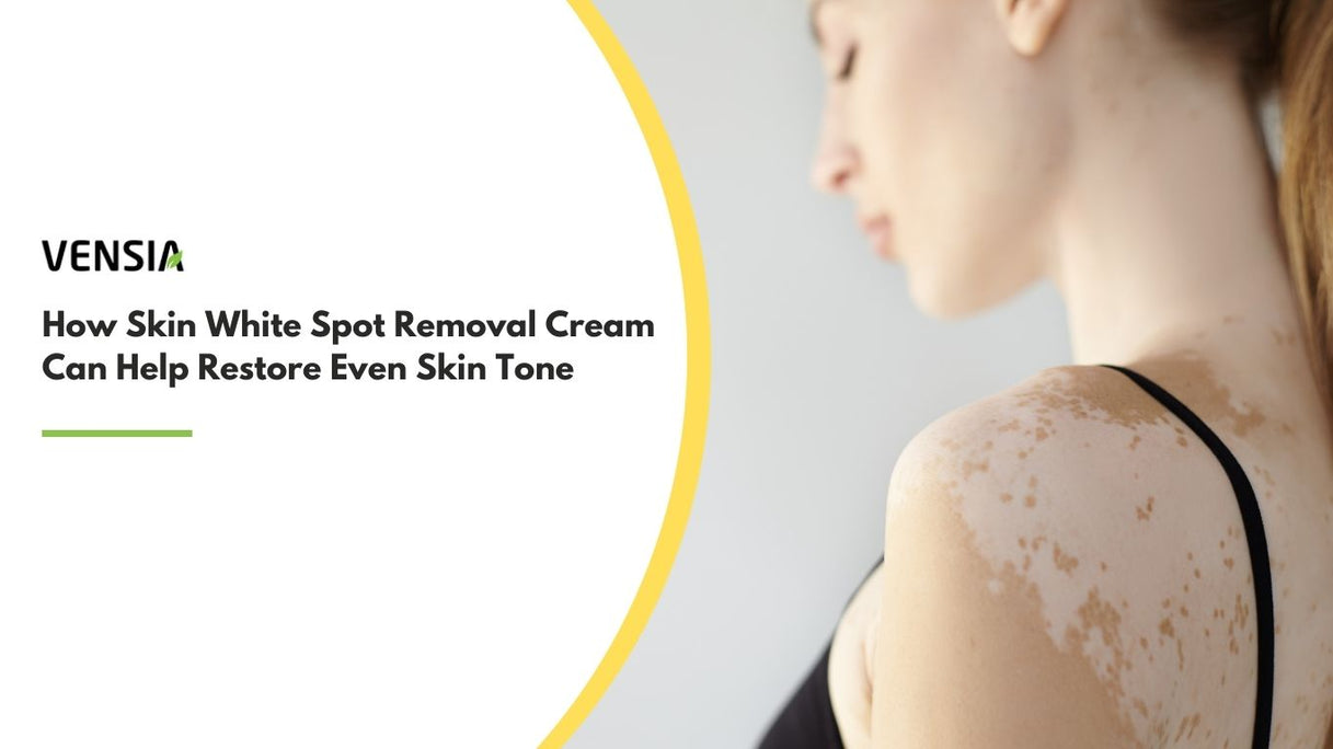 skin white spot removal cream
