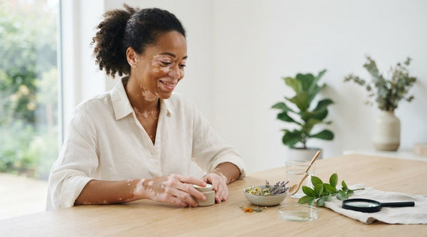 Vitiligo Natural Remedy: What Evidence Says and What to Consider in 2026