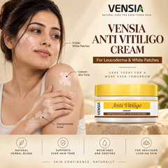 VENSIA Anti Pigmentation Cream +  Anti-Vitiligo Scar Removal Cream + Body Lotion Complete Skin Care Combo