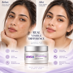 VENSIA Anti Pigmentation Cream +  Anti-Vitiligo Scar Removal Cream + Body Lotion Complete Skin Care Combo
