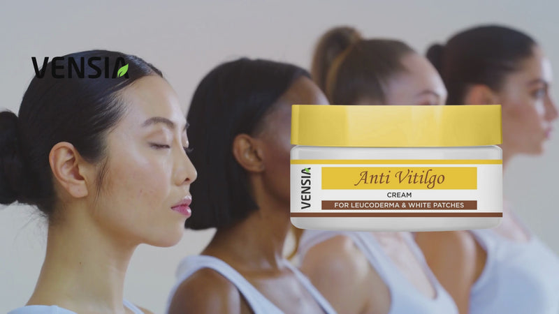 vensia anti vitiligo cream